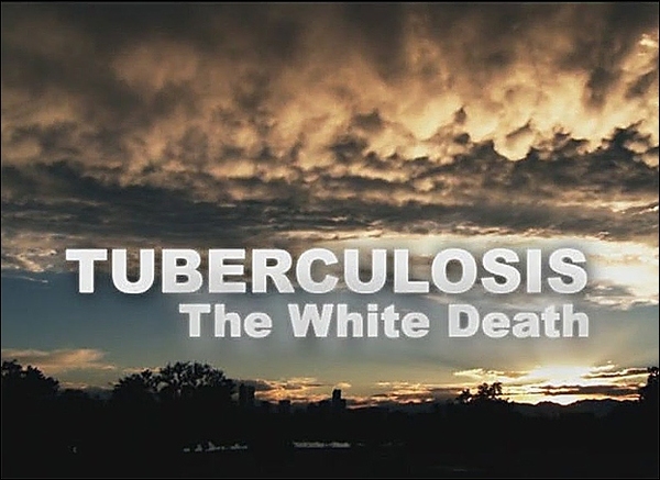 Stiahni si Dokument Tuberkuloza: Bila smrt / Tuberculosis: The White Death (2011)(CZ)(TVRip) = CSFD 53%