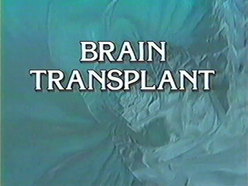 Stiahni si Dokument Transplantace mozku (1992) super dokument CZ Dub