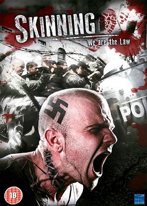 Stiahni si Filmy s titulkama Sisanje / Skinning (2010)(ENG)[720p] = CSFD 69%